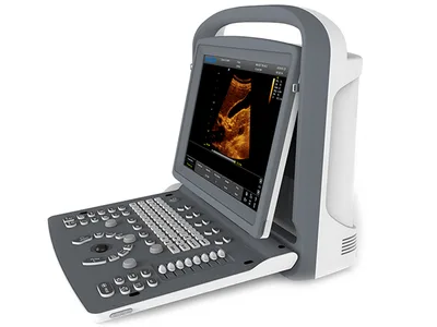 CHISON ECO2 B&W ULTRASOUND - 1 conector sondă