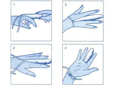 Singlefix finger dressing - adult