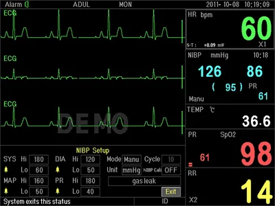 Monitor de pacient multi-parametru PC-3000
