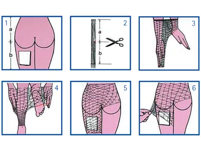 Plasă tubulară elastică Surgifix® G pentru corp, bazin, coapă - fără latex