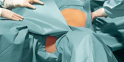 Set Gineco-Abdominal I, ranforsat
