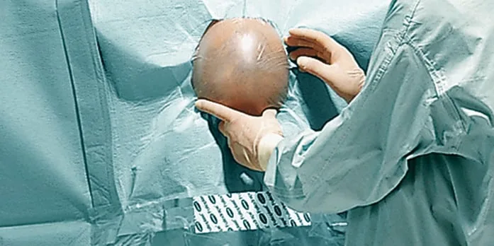 Set Neurochirurgie II